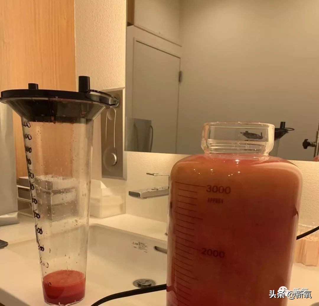 迷死氧亲身体验,我在日本吸掉了一桶脂肪和半张脸