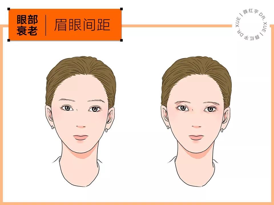 眼部抗衰最好方法,眼部抗衰效果图