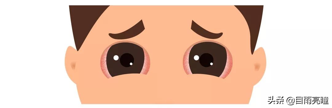 眼睛肿了应该怎么安慰,眼睛肿用什么敷好得快