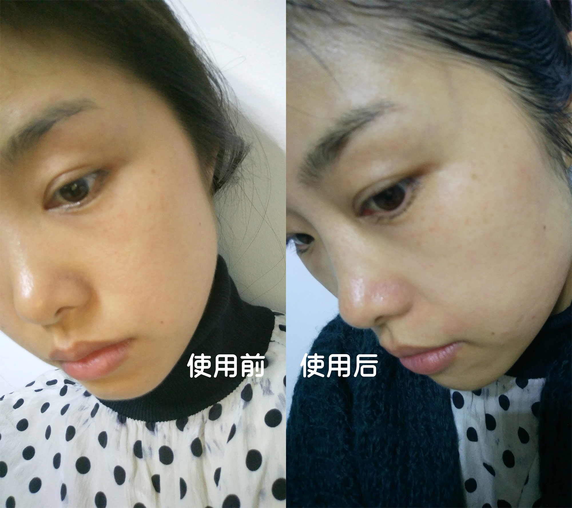 石墨烯美容黑科技,拥有了它,美了全家——若水石墨烯轻颜嫩肤仪