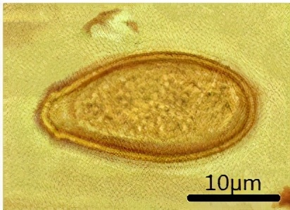 宠物寄生虫会传染人吗有什么症状,养宠物容易得寄生虫吗