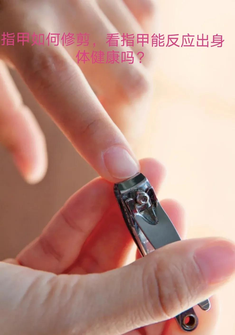 专家教你正确剪指甲的方式,正常指甲怎么修剪为健康