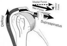 中医怎么看肩膀冈上肌疼痛,肩膀冈上肌疼痛