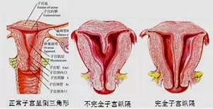 怎样的子宫内膜适合怀孕?吃柚子能长内膜?