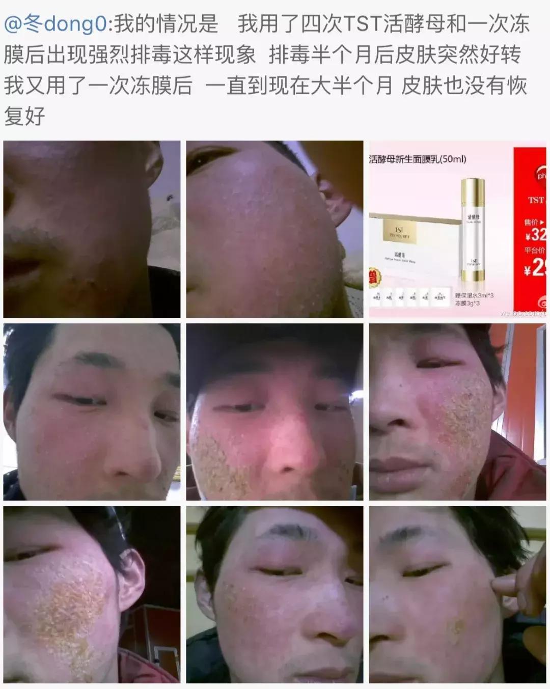 21亿智商税?屡遭质疑的微商面膜如此赚钱!林志玲陶虹都陷入了