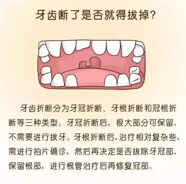 儿童摔断牙齿怎么治疗,孩子摔断门牙后该如何处理