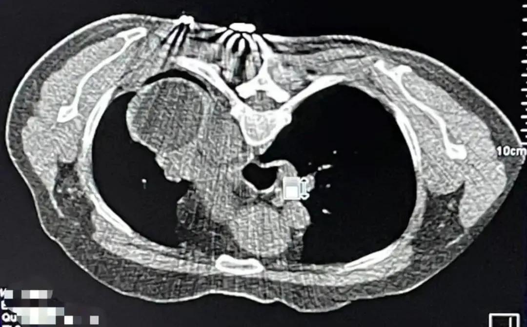 重庆大学附属肿瘤医院肿瘤内科,重庆大学附属肿瘤医院项目