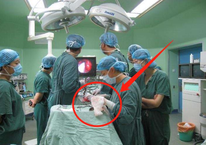 医院做人流的胎儿怎么处理,医院里面人流的胎儿怎么处理