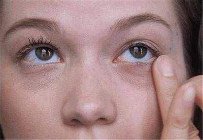 名门泽佳去眼袋价位,名门佳泽去眼袋靠谱吗