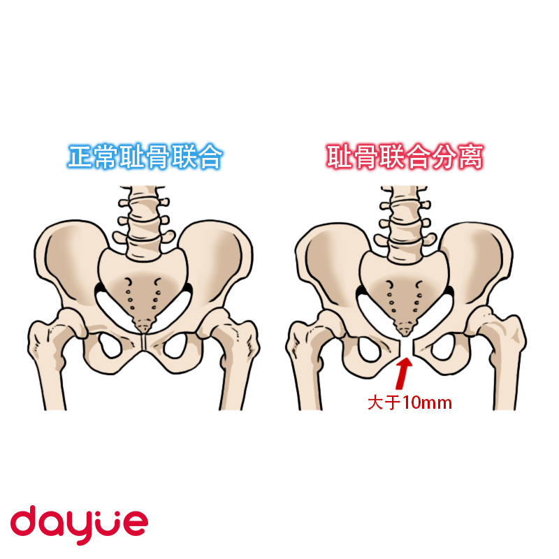产后修复你们都花了多少钱,产后恢复好花了多少钱