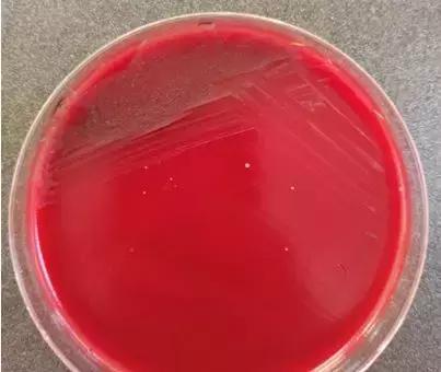 细菌感染血液检查结果,布鲁氏杆菌感染抽血检验