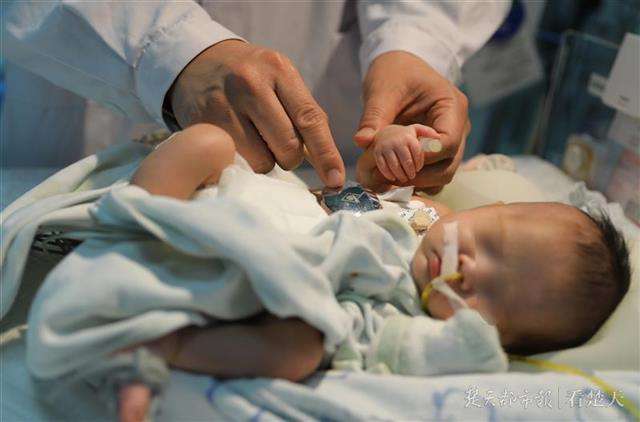 幼儿误食异物的急救步骤,婴儿误食异物怎么办妙招