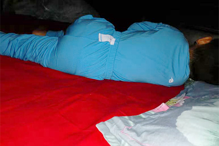 热疹湿疹和过敏的区别,宝宝过敏引起的湿疹怎么办