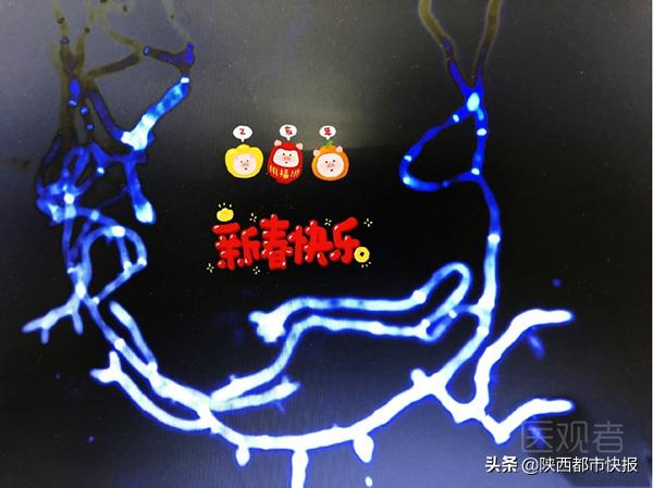 开脑洞！西安一皮肤科博士制作真菌拜年图堪称显微镜下的“表情包”