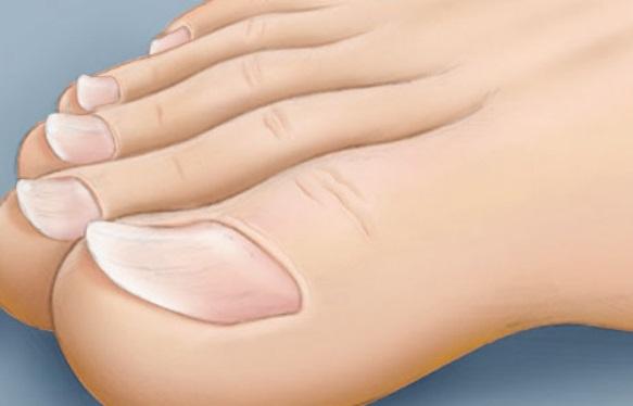 脚上有病有什么征兆,脚上有这三种症状赶紧去医院