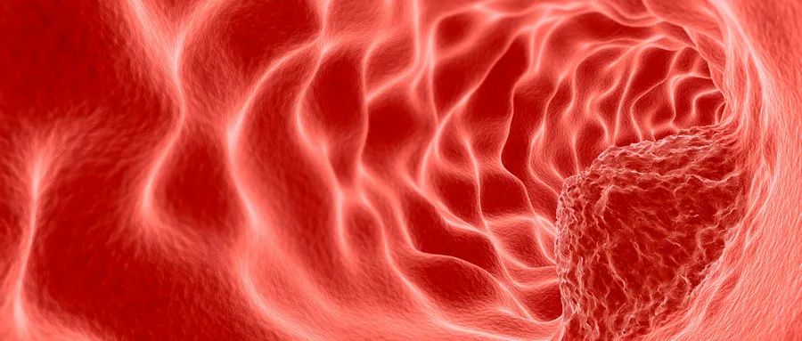 一分钟看懂宫颈癌筛查方法,一分钟看懂宫颈癌预后