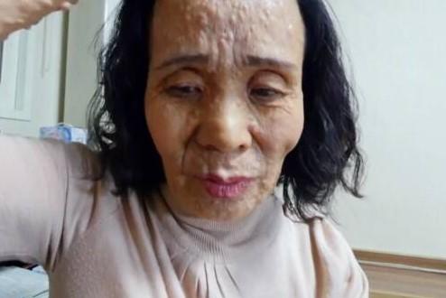 脸上长纤维瘤，父亲出走母亲改嫁，只剩弟弟却也车祸，我：做直播