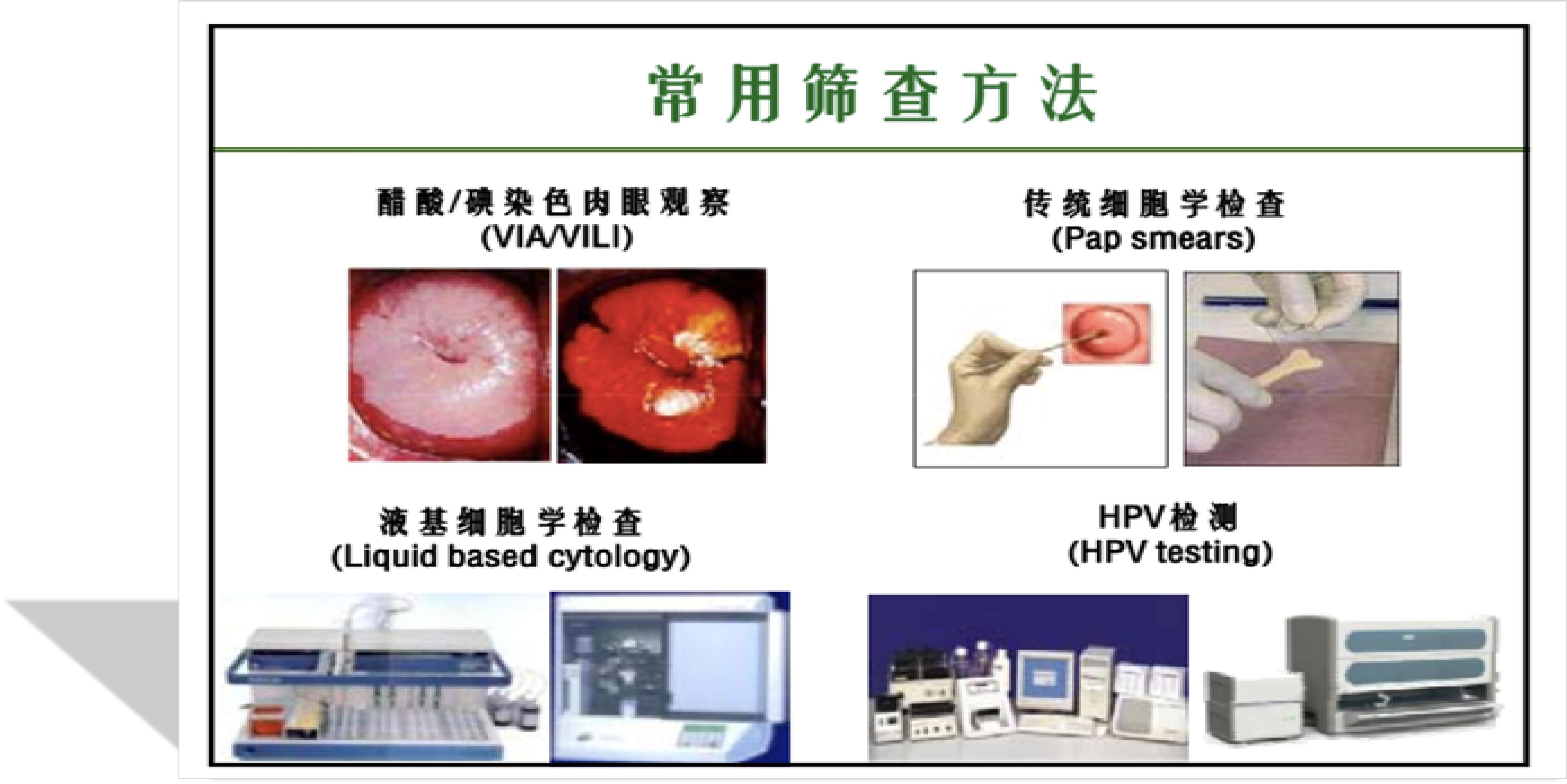 宫颈病变的诊断和治疗,宫颈病变的诊断和治疗华医网