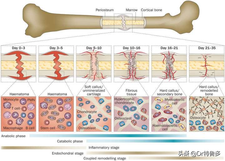 骨折了不长、长得慢怎么办?试试冲击波治疗吧