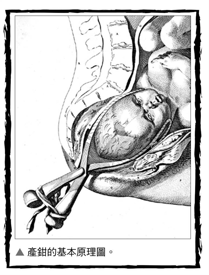 古代没有麻药剖腹产生孩子,古代没有产婆怎么生孩子