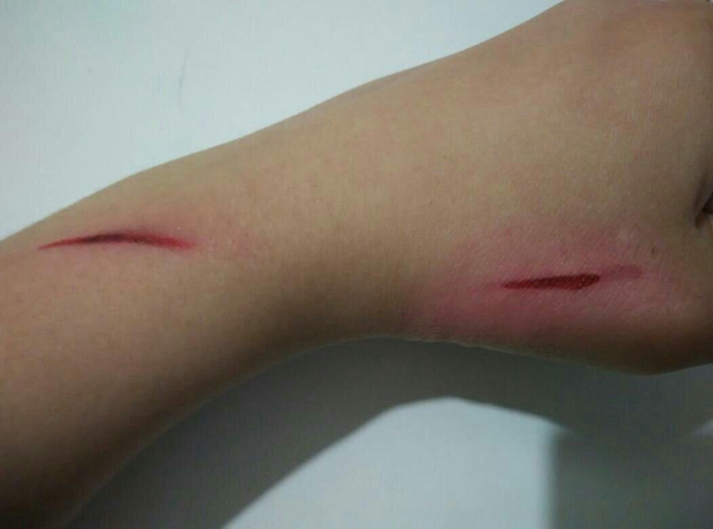 小孩子流行画伤疤吗,为什么孩子喜欢画伤口