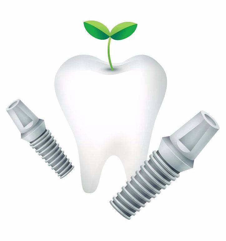 种植牙价格表影响因素,全口种植牙价格受哪些因素的影响