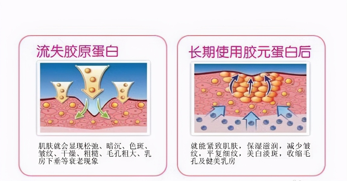 为什么抬头纹显得人这么老,多年的抬头纹怎么解决