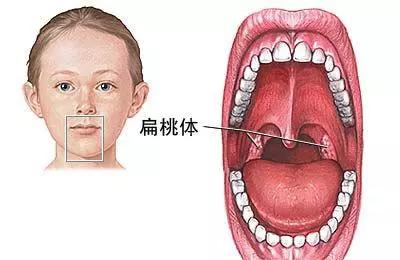 嗓子疼，喝口水都痛？那是因为这个器官出了问题