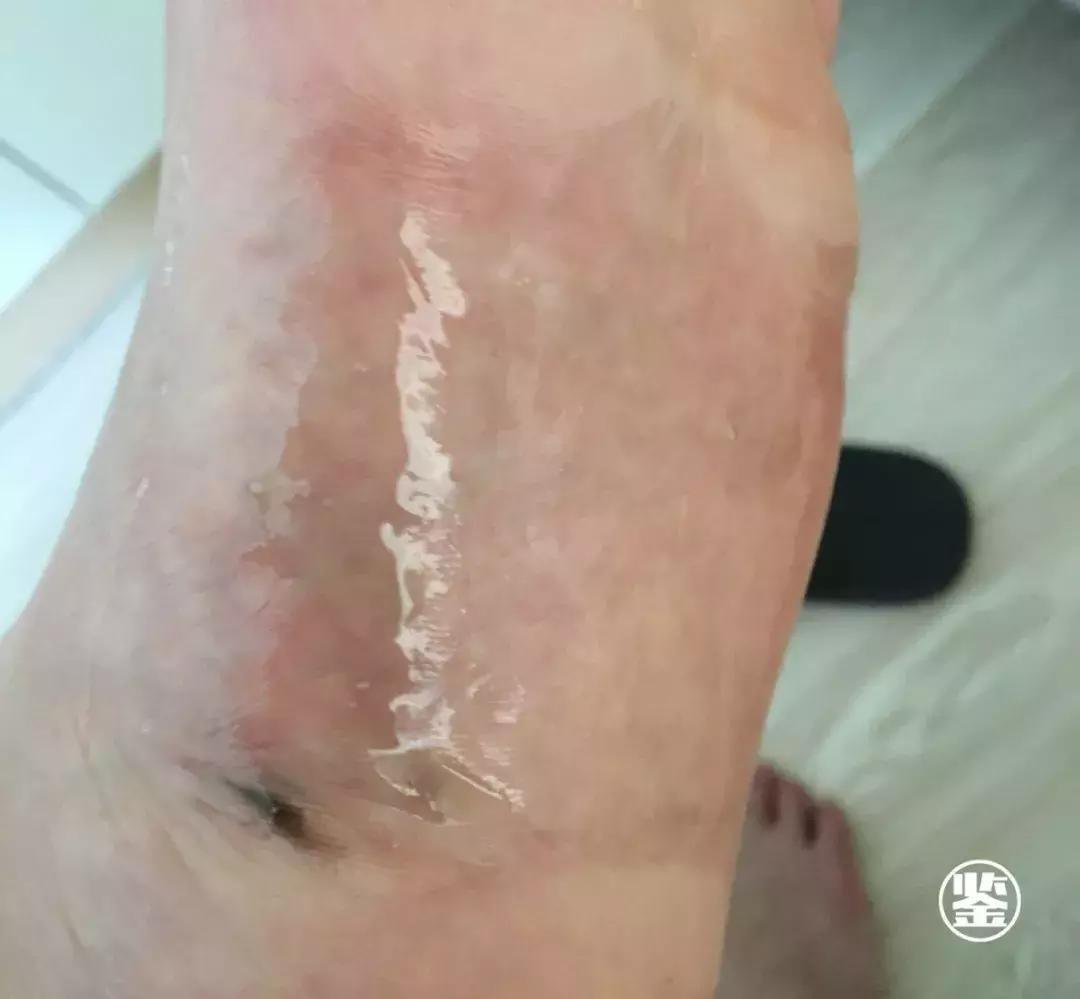 双十一我的第一个快递是假货！泰国爆款皇家足贴真假辨别