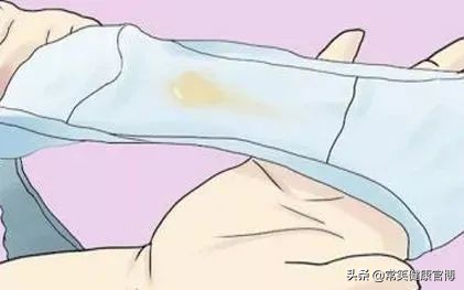 阴道炎有几种类型分别什么症状,阴道炎哪些症状表明已经很严重