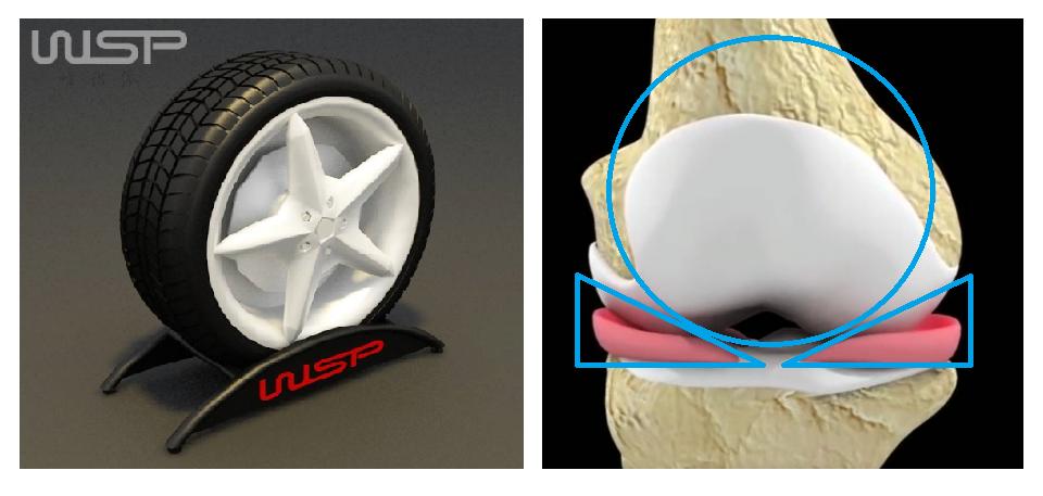 哪些明星半月板撕裂过,膝关节损伤的明星