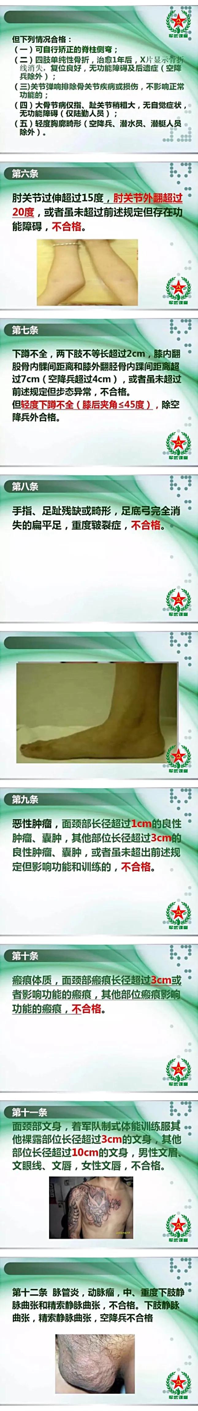 征兵体检标准ppt,征兵体检表电子版免费