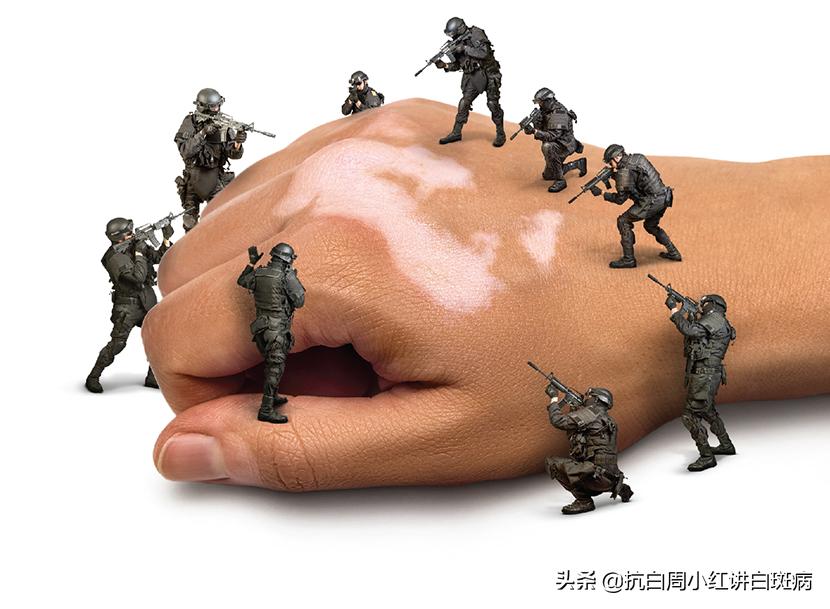 被猫抓伤会不会出现白癜风,撸猫被抓伤有保险吗