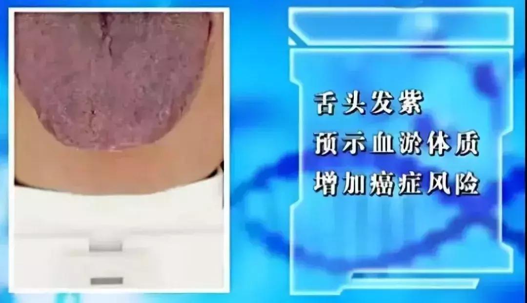 山药养脾的正确方法,养脾胃用哪种山药最好