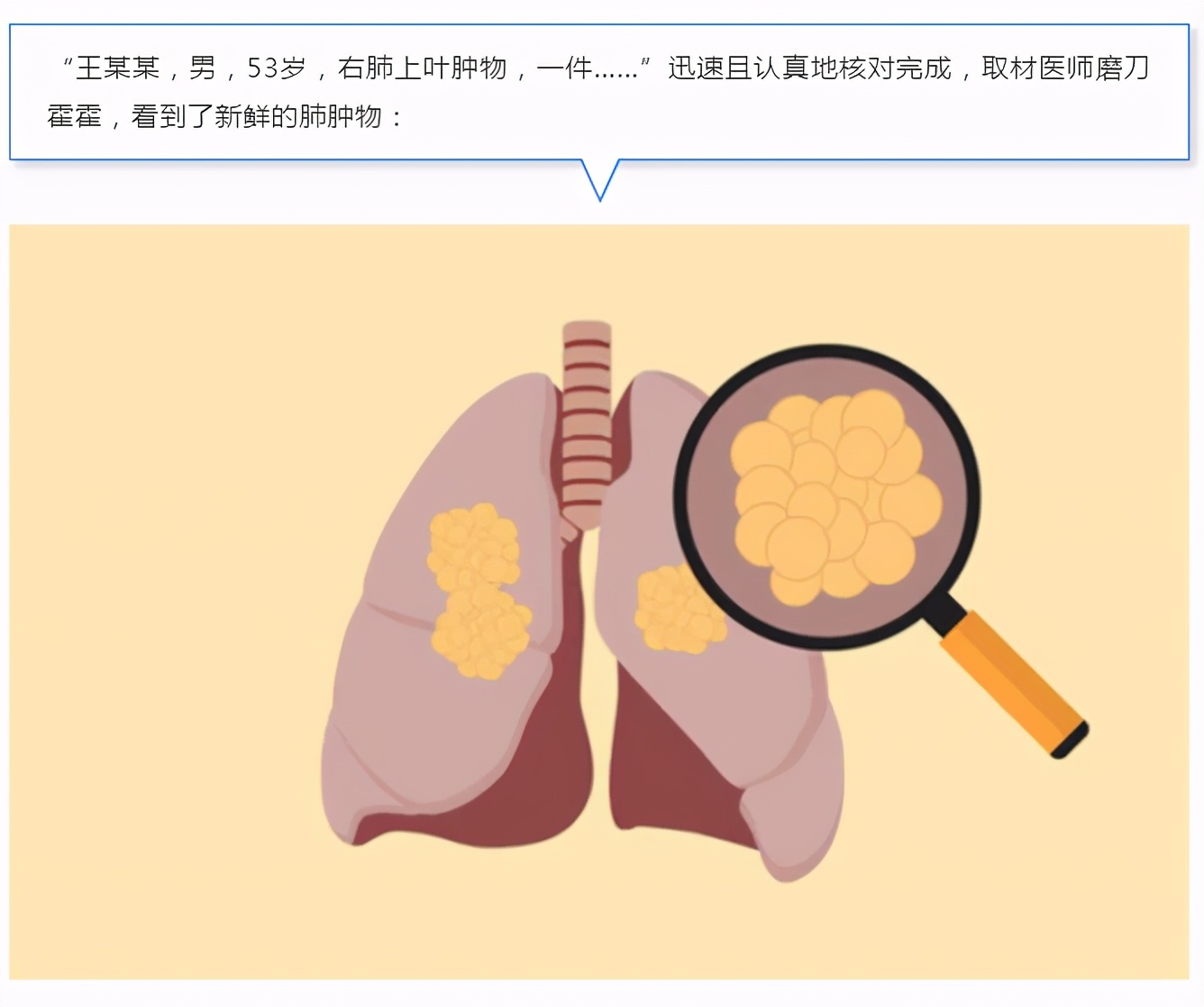 肿瘤防治科普视频,肿瘤冷冻切片和病理哪一个准确