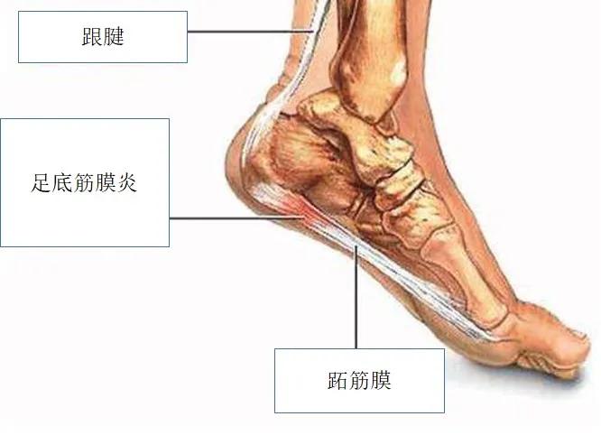 掌痛的最快解决办法,掌腕疼痛的治疗方法