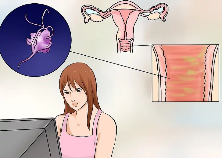 外阴癌的主要症状和表现,外阴癌的异常表现及预防