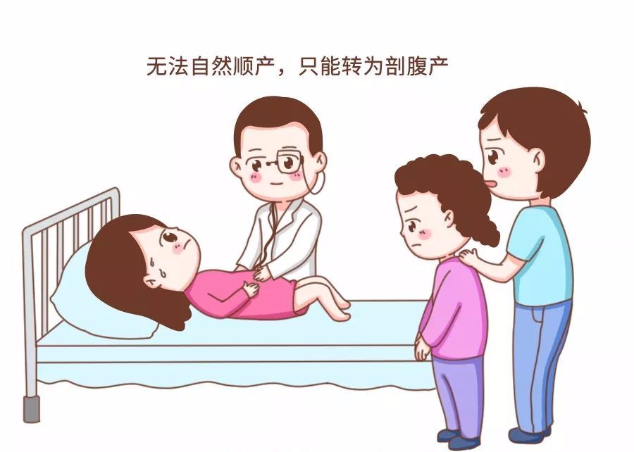顺产为什么要转为剖宫产,顺产还是剖腹产容易清宫