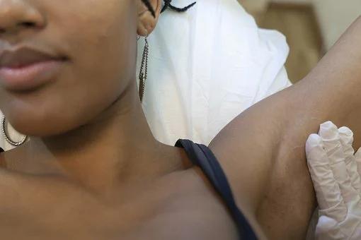 脱毛全攻略不再毛手毛脚,体毛脱毛的正确方法