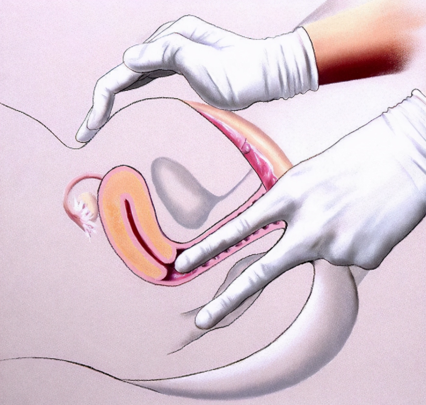 只有你才能真的保护好你自己,别耽误了检查