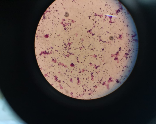 致死性B族链球菌感染,准妈妈不能忽视的产前筛查,你关注过吗?