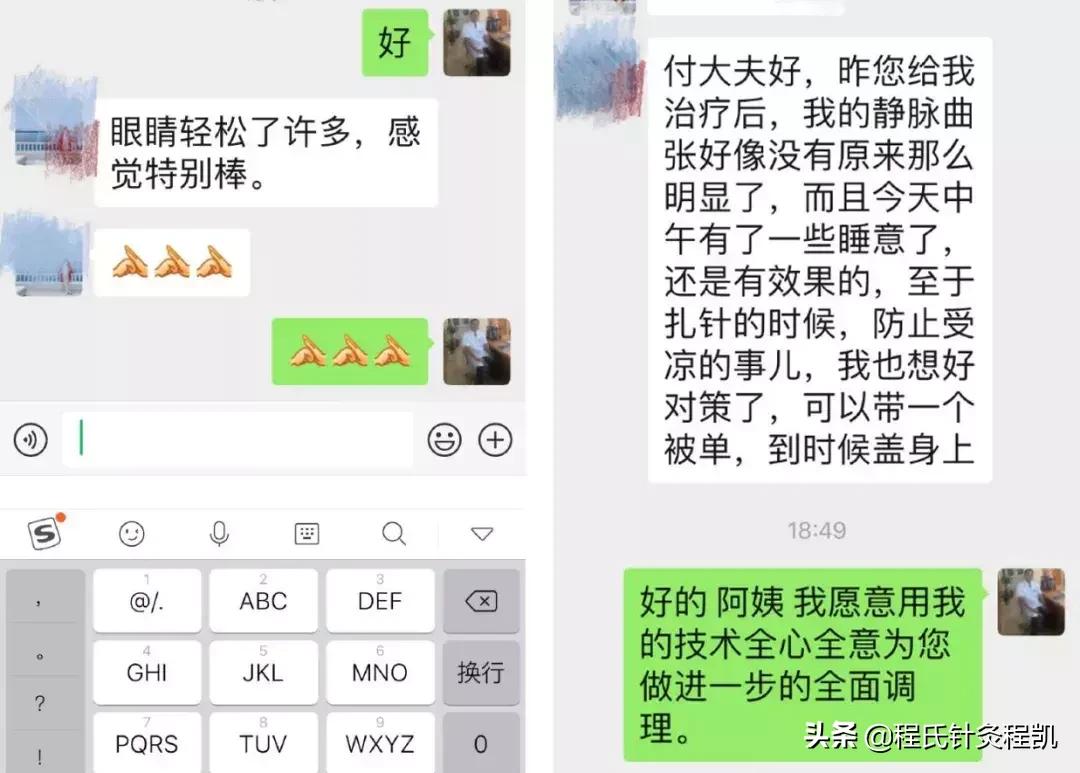 眼底黄斑变性中医治疗法,干眼症黄斑病变中医能治好吗