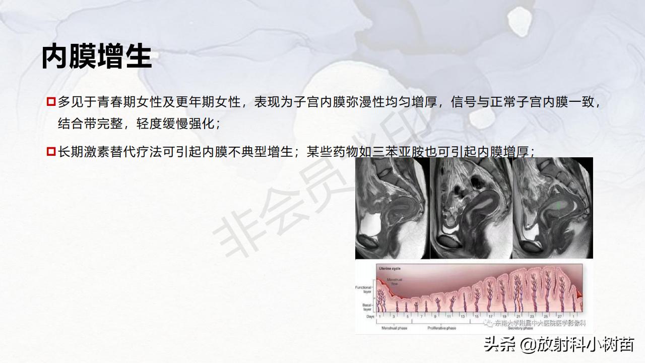 女性盆腔mri解剖图谱,泌尿生殖系统x线解剖