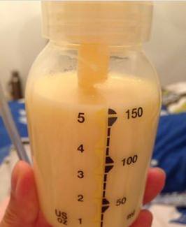 堵奶不想喂母乳要怎么办,堵奶严重找催乳师也没用怎么办