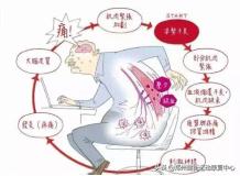 揭秘疼痛管理,解密肌筋膜疼痛