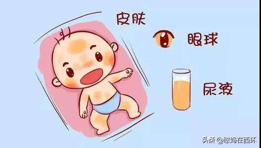 新生儿生理性黄疸病理性黄疸区别,新生儿黄疸与病理性黄疸怎样鉴别