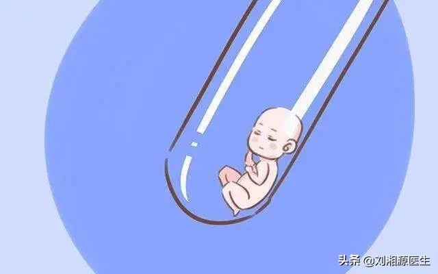 「免疫相关不良妊娠答疑解惑55」——复发性流产