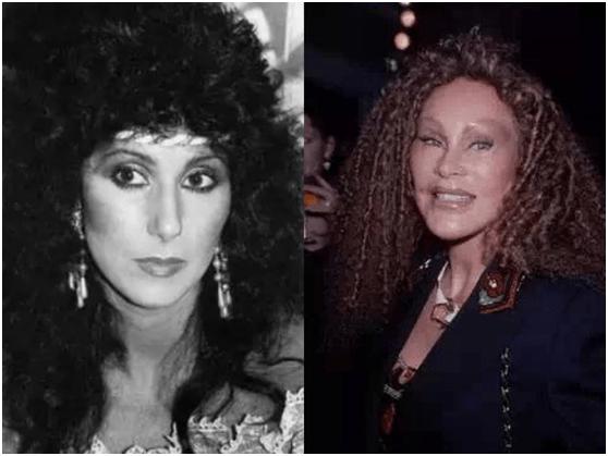 整容后老了会怎样知乎,整容过后老了是不是会更丑