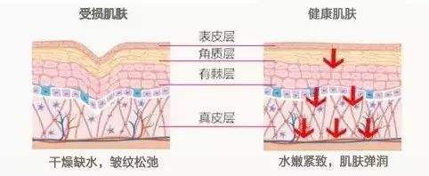 *血丝红**的自救指南，大家快来抄作业