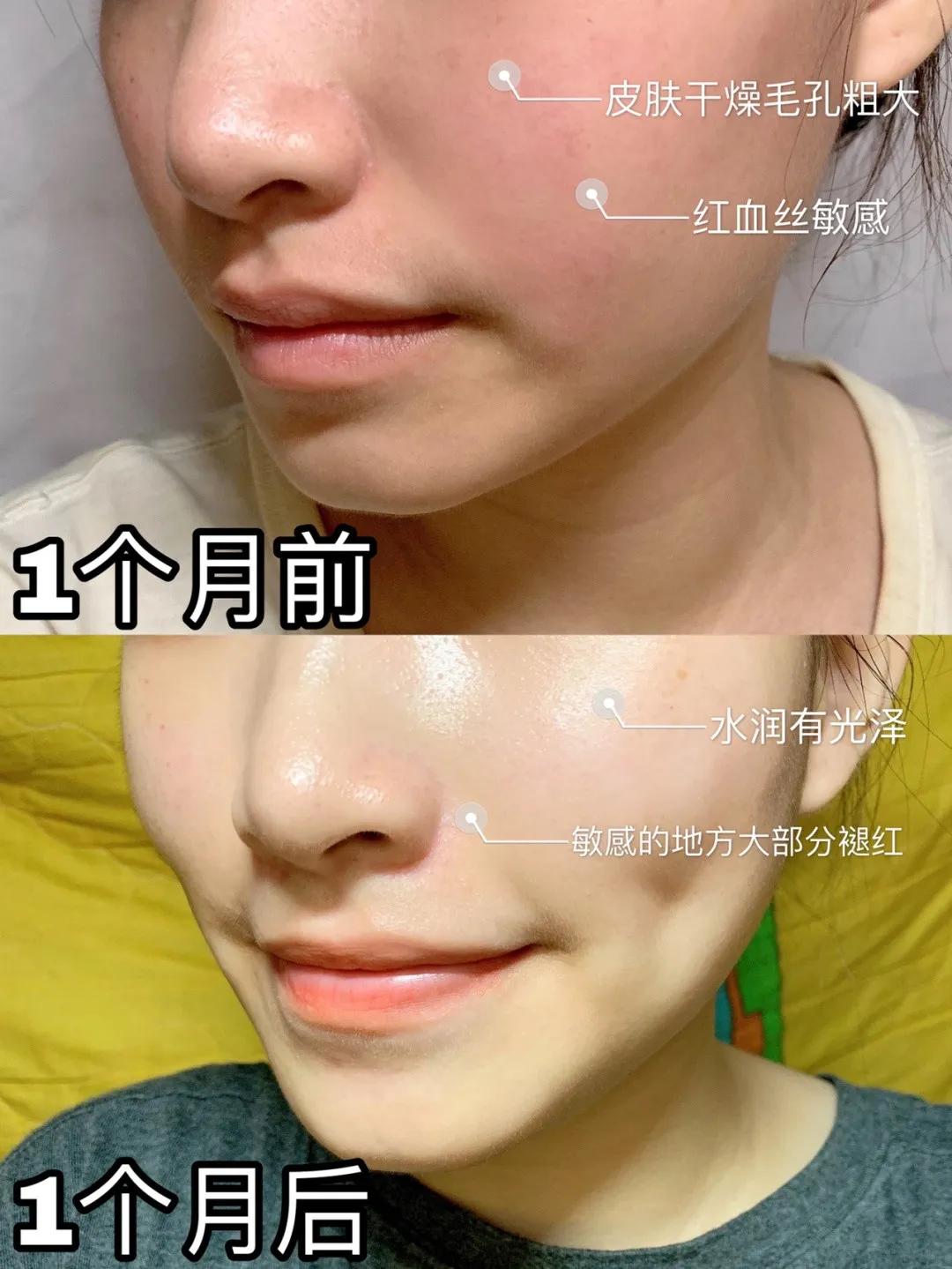 被李佳琦带火的国货,被李佳琦带起来的护肤品